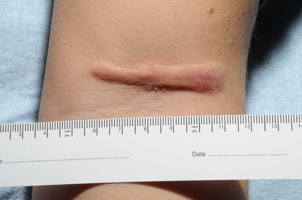 "Malattie misteriose" e "Malattie Tropicali": doppio appuntamento su Focus | Digitale terrestre: Dtti.it